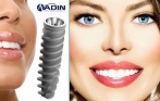 Имплантация ADIN за 11000 р., имплантация с одновременным удалением за 13 000 р., чистка зубов Air Flow в сети клиник Стома-Люкс. Импортные материалы и доступные цены!