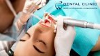 Скидки до 70% в стоматологической клинике Dental Clinic! 1290 р. УЗ-чистку + Air Flow + фторлак, 990 р. за лечение кариеса, 3500 р. за лечение пульпита, 1500 р. за КТ